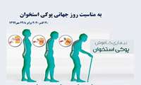 پوکی استخوان؛ بیماری خاموش / عدم فعالیت بدنی و ورزش های هوازی عاملی برای پوکی استخوان محسوب می شوند